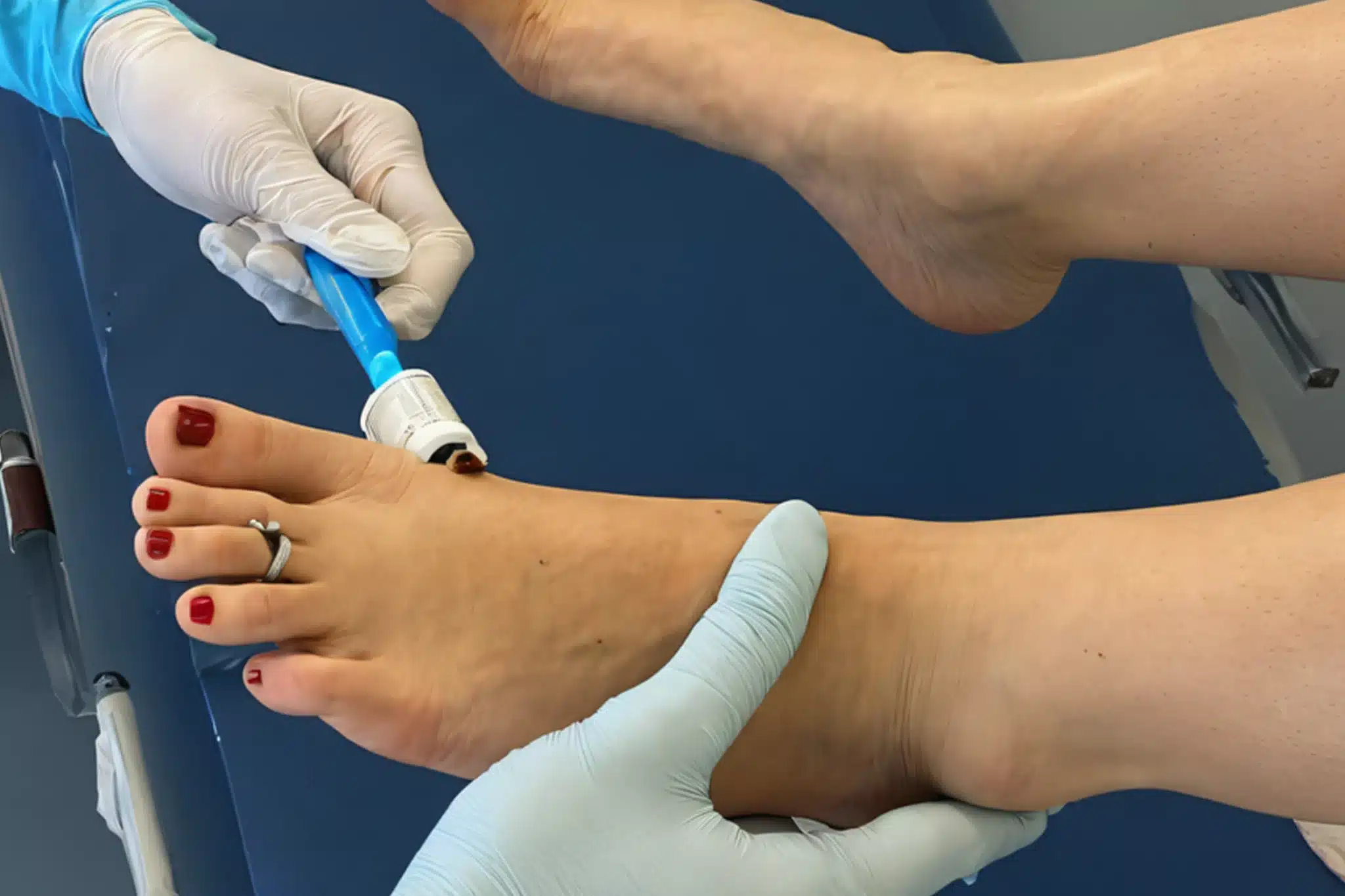 Mobile Wound Care Management Group: Diabetic Foot Ulcer Care scaled